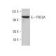 PDE5A Antibody (D-3) - Western Blotting - Image 381369 