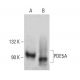 western blotting image from recommended PDE5A (D-3) monoclonal antibody replacement. Image 388033