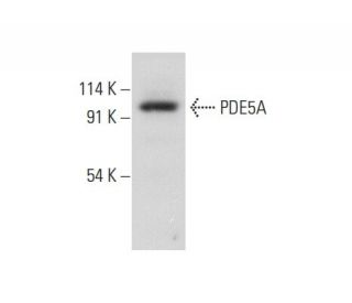 PDE5A Antibody (D-3) - Western Blotting - Image 308176The Double Nickase Plasmid features a U6 promoter for sgRNA expression, a 20 nt targeting sequence, and a gRNA scaffold to guide Cas9n. It includes a CBh promoter for Cas9n (D10A) and puromycin resistance, GFP for transfection verification, and nuclear localization signals (NLS). The 2A peptide allows co-expression of Cas9n and Puro from a single promoter, enabling precise genome editing with reduced off-target effects.