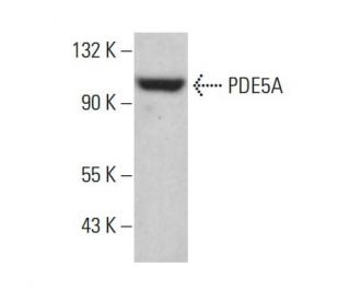 PDE5A Antibody (D-3) - Western Blotting - Image 381369The Double Nickase Plasmid features a U6 promoter for sgRNA expression, a 20 nt targeting sequence, and a gRNA scaffold to guide Cas9n. It includes a CBh promoter for Cas9n (D10A) and puromycin resistance, GFP for transfection verification, and nuclear localization signals (NLS). The 2A peptide allows co-expression of Cas9n and Puro from a single promoter, enabling precise genome editing with reduced off-target effects.