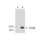 PDE6β Antibody (B-8) - Western Blotting - Image 285032