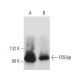 PDE6β Antibody (B-8) - Western Blotting - Image 389151 