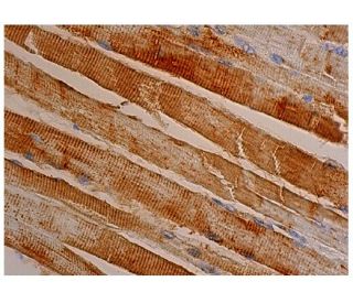 immunohistochemistry image from recommended PDE7A (B-11) monoclonal antibody replacement. Image 346433