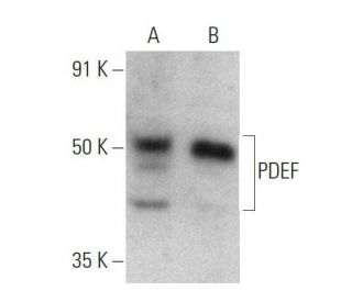 PDEF Antibody (G-10) - Western Blotting - Image 358556 