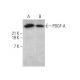 western blotting image from recommended PDGF-A (E-10) monoclonal antibody replacement. Image 375579