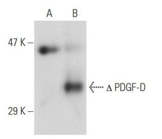 PDGF-D Antibody (E-6) - Western Blotting - Image 55431
