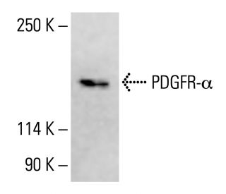 PDGF Receptor alpha/PDGFRA Antibody (C-9) - Western Blotting - Image 415435