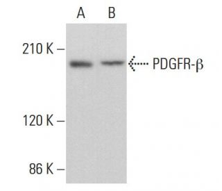 PDGF Receptor beta/PDGFRB Antibody (D-6) - Western Blotting - Image 375505