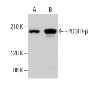 PDGF Receptor beta/PDGFRB Antibody (D-6) - Western Blotting - Image 375503