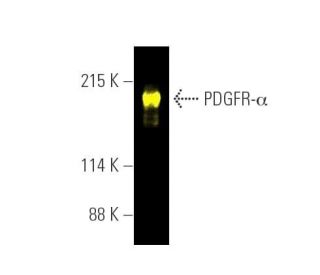 その他 flk040210 PDGF Receptor alpha/PDGFRA抗体(C-9) | SCBT - Santa Cruz Biotechnology