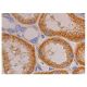 immunohistochemistry image from recommended PDGF Receptor beta/PDGFRB (D-6) monoclonal antibody replacement. Image 352969