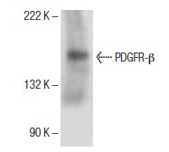 pdgfr-beta-antibody-d-6-