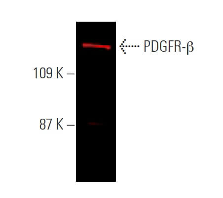 PDGF Receptor beta/PDGFRB Antibody (D-6) | SCBT - Santa Cruz