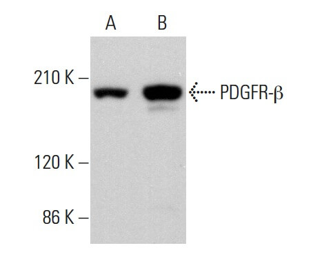 pdgfr-beta-antibody-d-6-