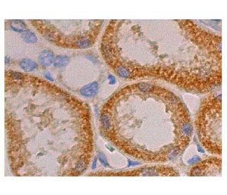 immunohistochemistry image from recommended PDGF Receptor beta/PDGFRB (D-6) monoclonal antibody replacement. Image 352969