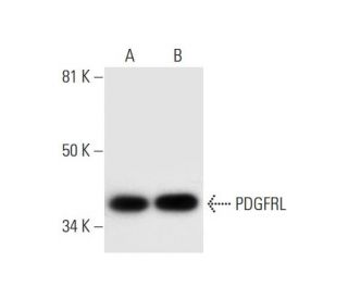 PDGFRL Antibody (F-2) - Western Blotting - Image 294771 