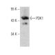 PDK1 Antibody (E-10) - Western Blotting - Image 385717