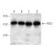 PDK2 Antibody (180CT10.2.3) - Western Blotting - Image 374562