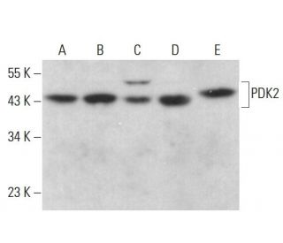 PDK2 Antibody (3F2D7) - Western Blotting - Image 376455 