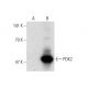 PDK2 Antibody (S-15) - Western Blotting - Image 139188 