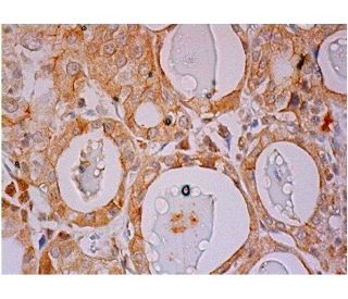 PDK3 Antibody (A-4) - Immunohistochemistry - Image 286379 