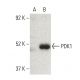 PDK4 Antibody (A-7) - Western Blotting - Image 395975 