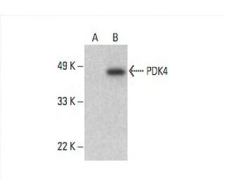PDK4 Antibody (B-1) - Western Blotting - Image 393094