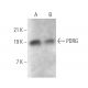 PDRG Antibody (C-9) - Western Blotting - Image 372395 