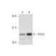PDSS2 Antibody (F-5) - Western Blotting - Image 344166 