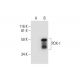 western blotting image from recommended PDX-1 (B-11) monoclonal antibody replacement. Image 290022