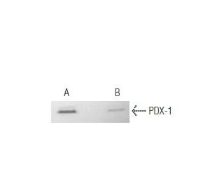PDX-1 siRNA (r): sc-108040. Immunoblotting of PDX-1 expression using PDX-1 antibody on INS1 cell extracts treated with Con 