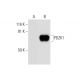 PDZK1 Antibody (H-1) - Western Blotting - Image 290936 