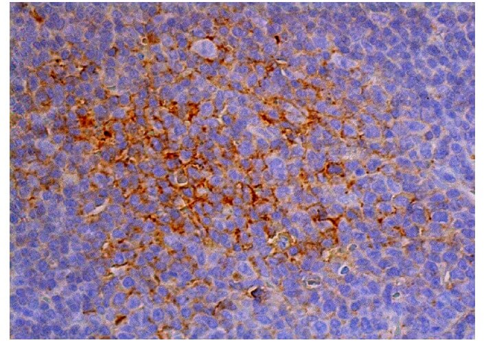 CD31/PECAM-1 Antibody (D-11) | SCBT - Santa Cruz Biotechnology