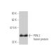 PEN-2 Antibody (1C12-G5) - Western Blotting - Image 350230