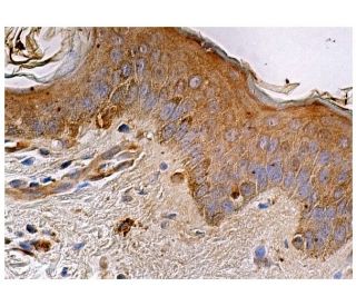 PEPCK/PCK1/PCK2 Antibody (E-1) | SCBT - Santa Cruz Biotechnology