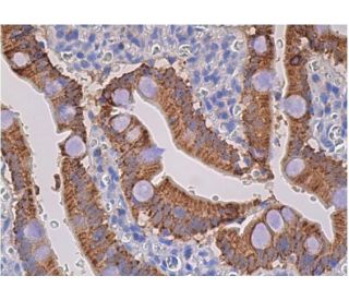 しあん PEPCK/PCK1/PCK2 Antibody (F-3) | SCBT - Santa Cruz Biotechnology