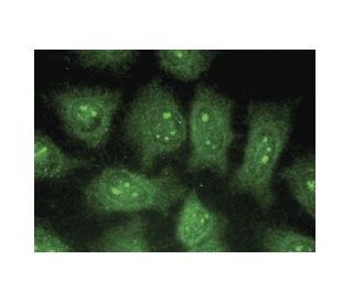 PEPCK-C/PCK1 Antibody (A-3) - Immunofluorescence - Image 149821 