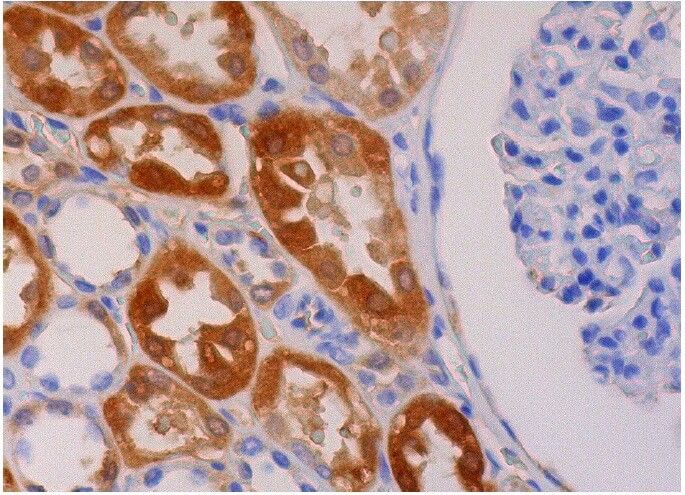 PEPCK-C/PCK1 Anticorpo (F-11) | SCBT - Santa Cruz Biotechnology