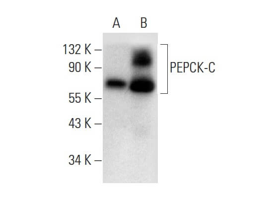 PEPCK-C/PCK1 Antibody (G-9) | SCBT - Santa Cruz Biotechnology
