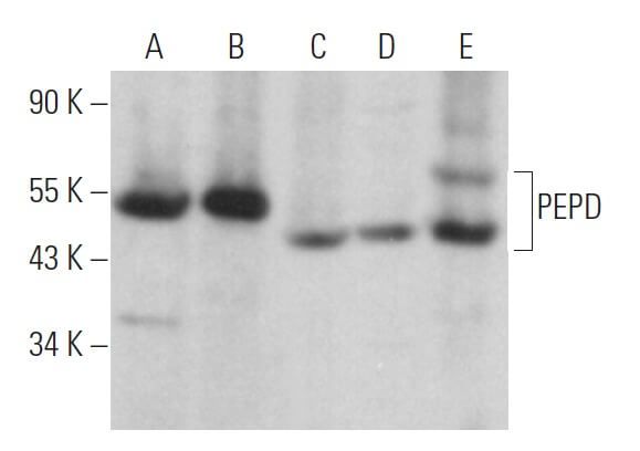 Pepd PEPD Antibody (A-3) | SCBT - Santa Cruz Biotechnology