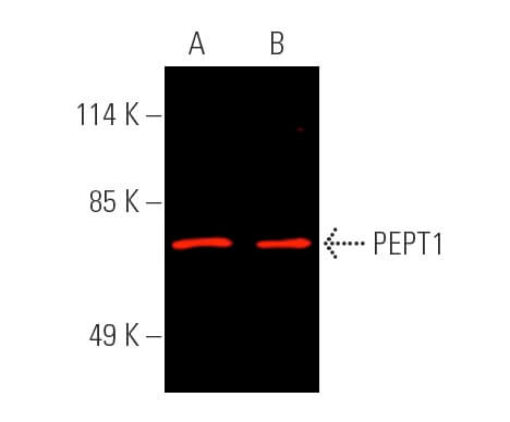 PEPT1 Antibody (E-3) | SCBT - Santa Cruz Biotechnology
