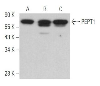 western blotting image from recommended PEPT1 (E-3) monoclonal antibody replacement. Image 362123