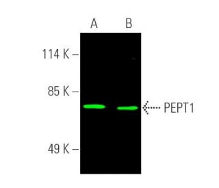 PEPT1 Antibody (E-3) - Western Blotting - Image 389758