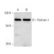 Perforin 1 Antibody (δG9) - Western Blotting - Image 11375