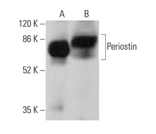western blotting image from recommended Periostin (F-10) monoclonal antibody replacement. Image 378768
