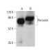 This polyclonal antibody has been discontinued. See our recommended <a href="periostin-antibody-f-10">Periostin (F-10)</a> monoclonal antibody (sample data shown). western blotting image from recommended Periostin (F-10) monoclonal antibody replacement. Image 378768