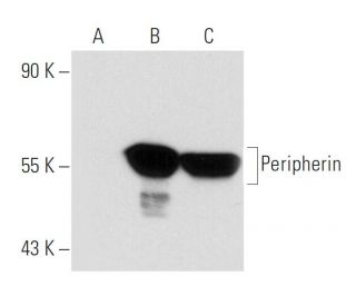 Peripherin Antibody (8G2) - Western Blotting - Image 48204 