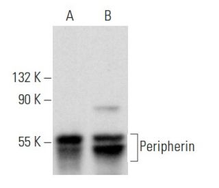 Peripherin Antibody (A-3) - Western Blotting - Image 358001 