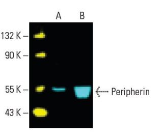 Peripherin Antibody (A-3) - Western Blotting - Image 396266 