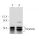 western blotting image from recommended Peripherin (A-3) monoclonal antibody replacement. Image 358001